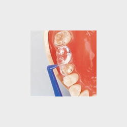 Instruktionsmodel til Tandbrstning 